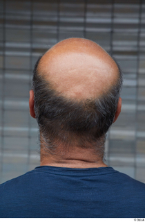 Street references  610 bald hair head 0001.jpg
